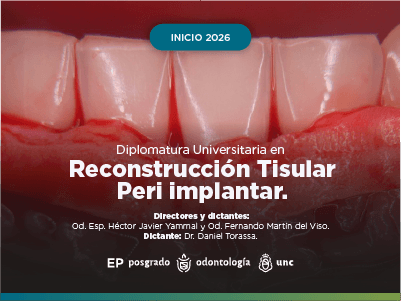 Diplomatura Universitaria de Estudios Avanzados en Reconstrucción Tisular Peri implantar.2026.
